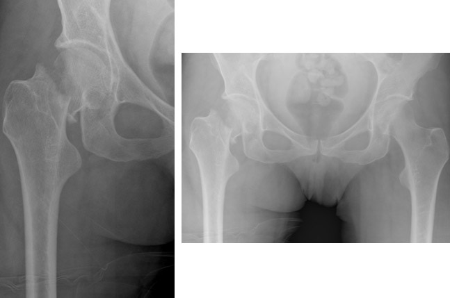Des nouvelles de nos voisins suisses