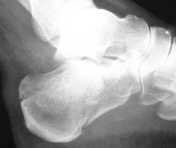 Une deuxi�me chance&nbsp;?