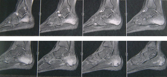 La d�charge, �a marche