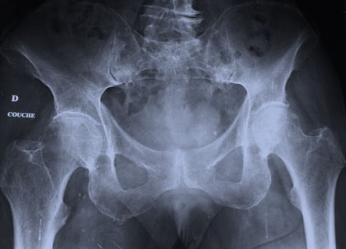 Une douleur pr�monitoire