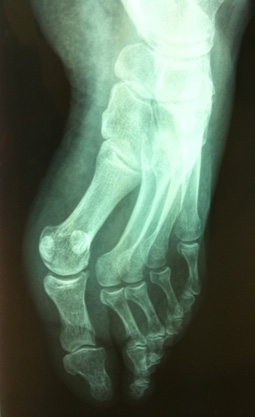 Une am�lioration de l�imagerie