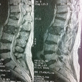 Une triste agression