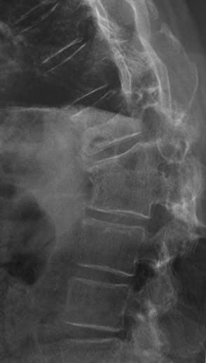 Une succession de malchance