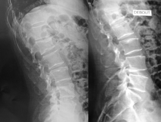 L�homme est complexe