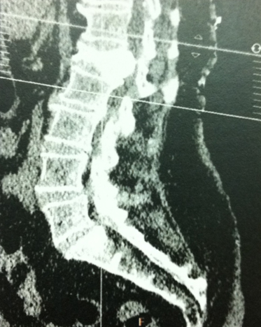 Et si on cimente&nbsp;?