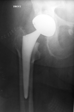 Un �chec parmi des r�ussites