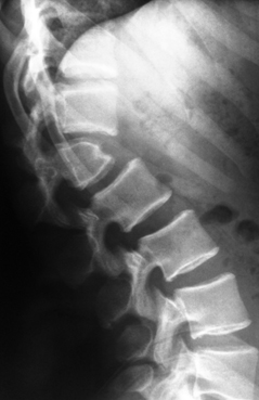 Toujours les difficult�s des certificats