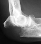 Attention au freinage