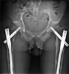 Explorer en diminuant l�irradiation