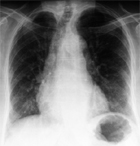 De la difficult� de la m�decine