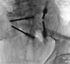 Et on cimente ici aussi&nbsp;?