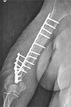 Attention � la chute