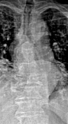 Il faut faire des � VFA �