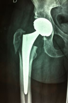 Attention au traitement des confr�res