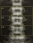 Trop d�os est douloureux