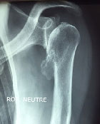 Comment aider ce patient&nbsp;? 