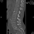 Du ciment bien plac�