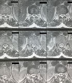 Une d�couverte fortuite&nbsp;? 