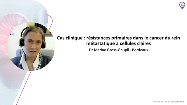 Cas clinique&nbsp;: r�sistances primaires dans le cancer du rein m�tastatique � cellules claires