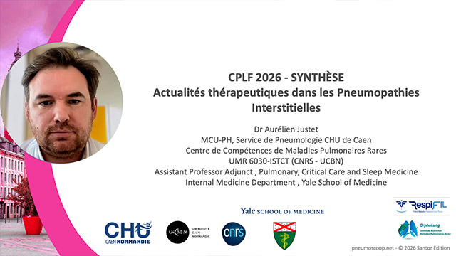 video, interview, imedia