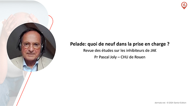 video, interview, imedia