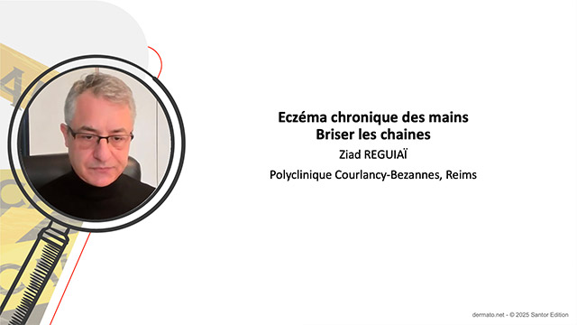 video, interview, imedia