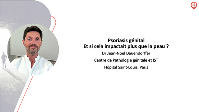 video, interview, imedia