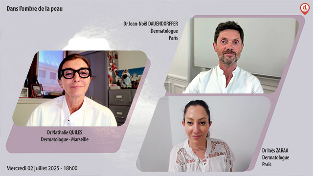 webcast, direct, live, streaming