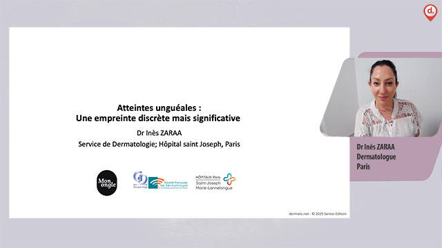 video, interview, imedia
