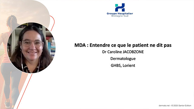 video, interview, imedia