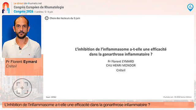 L'inhibition de l'inflammasome a-t-elle une efficacit&eacute; dans la gonarthrose inflammatoire&nbsp;?