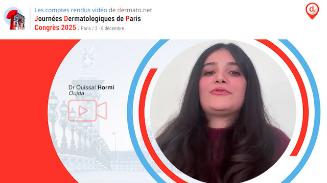 video, interview, imedia