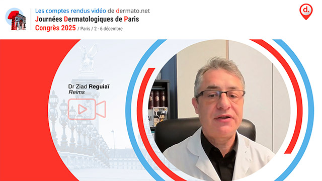 video, interview, imedia