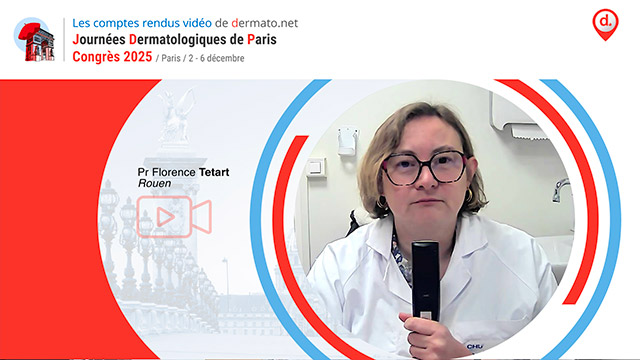 video, interview, imedia