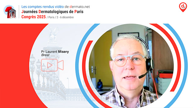 video, interview, imedia