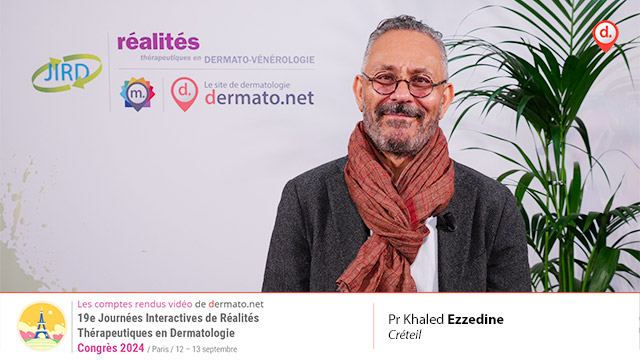 video, interview, imedia