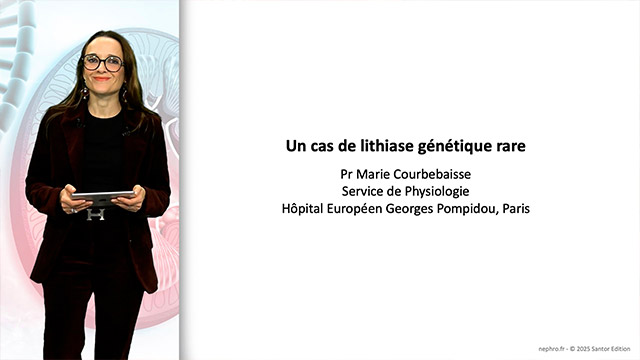 Cas clinique&nbsp;: Un cas de lithiase g&eacute;n&eacute;tique rare