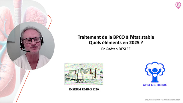 video, interview, imedia