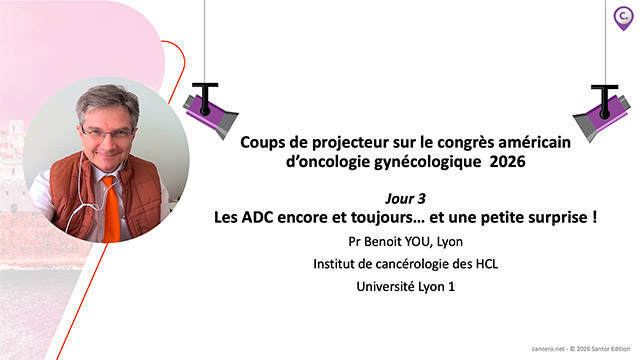 video, interview, imedia