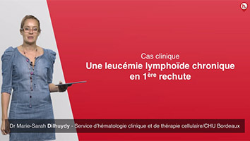 Une leuc�mie lympho�de chronique en 1�re rechute