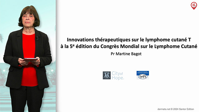 video, interview, imedia