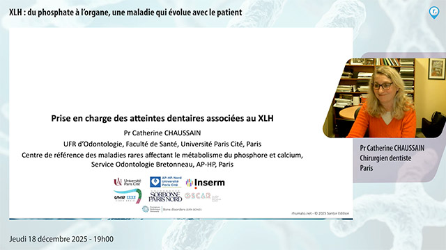 video, interview, imedia