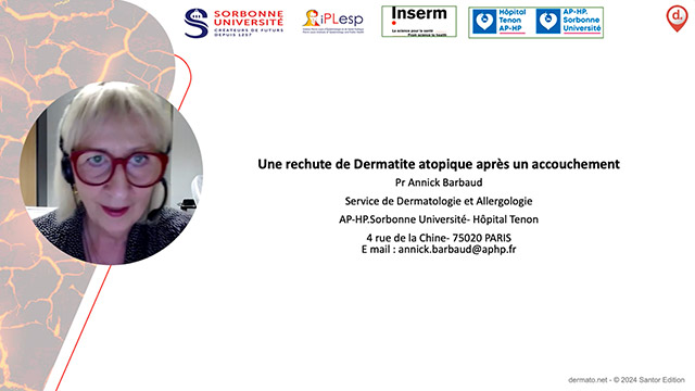 Cas clinique&nbsp;: une rechute de dermatite atopique apr�s un accouchement