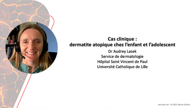 Cas clinique&nbsp;: dermatite atopique chez l'enfant et l'adolescent