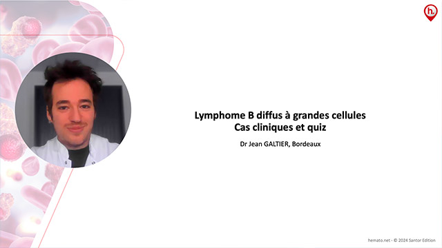 Lymphome B diffus � grandes cellules