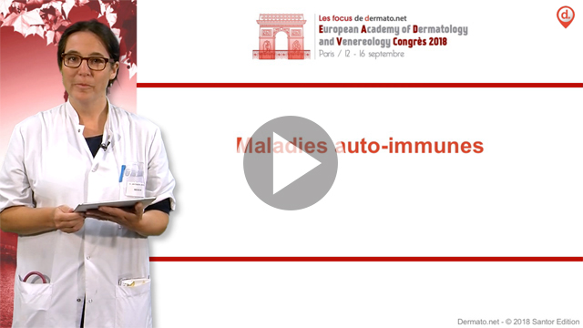 video, interview, imedia