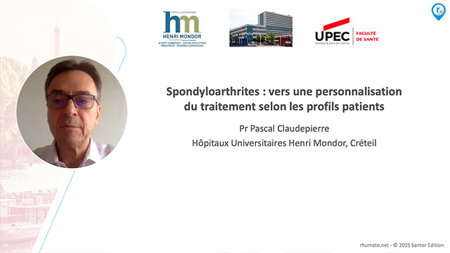 video, interview, imedia