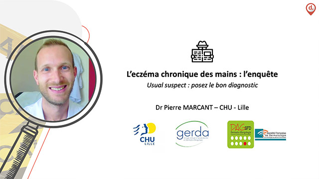 video, interview, imedia