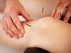 Acupuncture pour douleur du genou&nbsp;: �tude clinique randomis�e