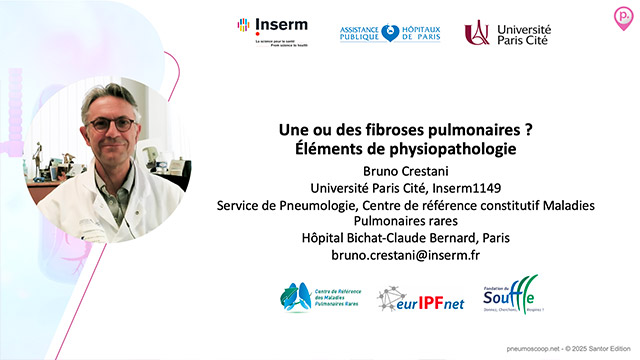 video, interview, imedia